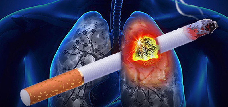 10 Thói quen khiến phổi 'chết dần chết mòn' phải bỏ ngay nếu muốn sống lâu 2